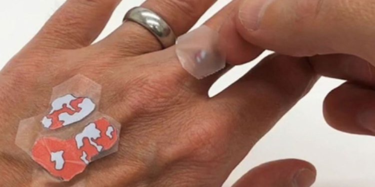 Les patchs cutanés transparents promettent aux patients atteints de psoriasis un traitement mieux centré sur l’être humain